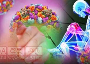 சிக்குன்குன்யா நோய் குறித்து விடுக்கப்பட்டுள்ள எச்சரிக்கை