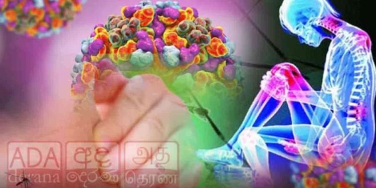 சிக்குன்குன்யா நோய் குறித்து விடுக்கப்பட்டுள்ள எச்சரிக்கை