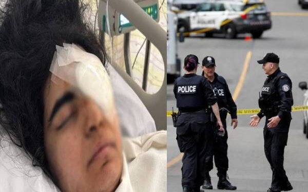 கனடாவில் கொடூரமாகத் தாக்கப்பட்ட இந்திய இளம்பெண்