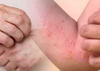 குழந்தைகளிடையே வேகமாக பரவும் நோய்கள்!