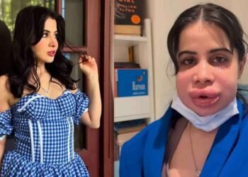 செயற்கை அழகை தேடி சென்ற நடிகைக்கு நேர்ந்த சோகம் – ஆபத்தில் முடிந்த அழகு சிகிச்சை