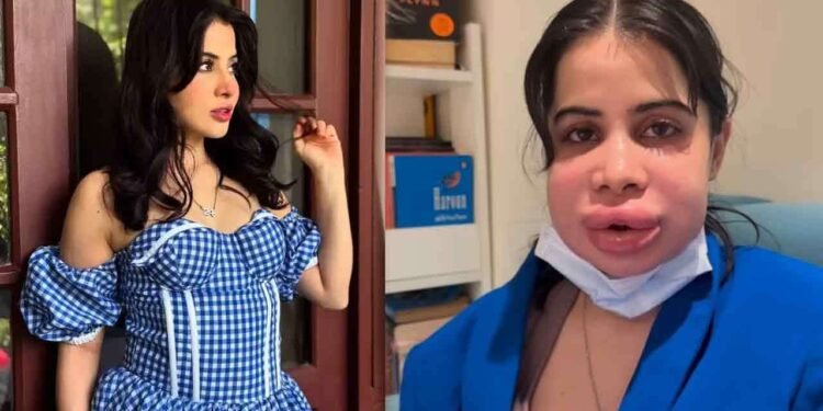 செயற்கை அழகை தேடி சென்ற நடிகைக்கு நேர்ந்த சோகம் – ஆபத்தில் முடிந்த அழகு சிகிச்சை