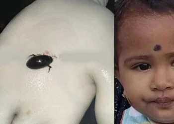 வண்டை விழுங்கிய ஒரு வயது பெண் குழந்தை பலி