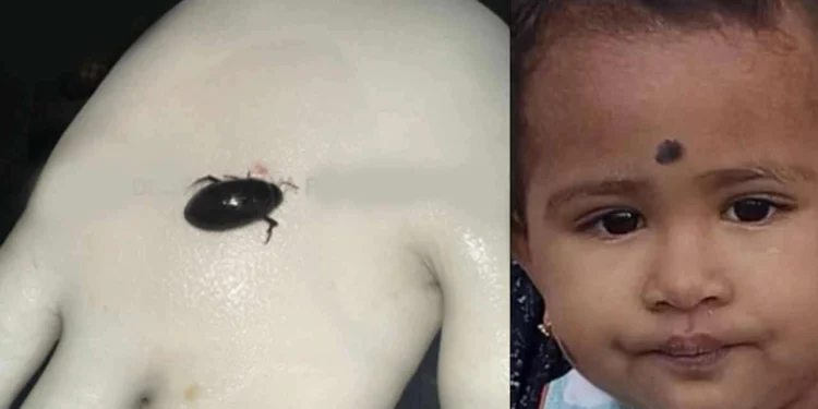 வண்டை விழுங்கிய ஒரு வயது பெண் குழந்தை பலி