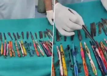 வாலிபர் வயிற்றில் 29 கரண்டிகள், 19 பிரஷ்கள்: அதிர்ச்சியில் மருத்துவர்கள்!