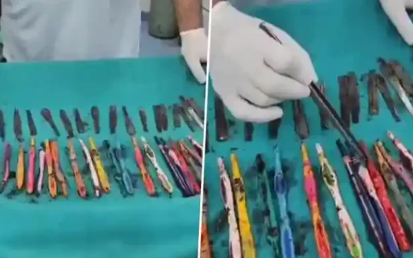 வாலிபர் வயிற்றில் 29 கரண்டிகள், 19 பிரஷ்கள்: அதிர்ச்சியில் மருத்துவர்கள்!