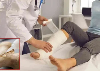 எலும்பு முறிவை 3 நிமிடத்தில் சரிசெய்யும் புதிய பசை கண்டுபிடிப்பு!