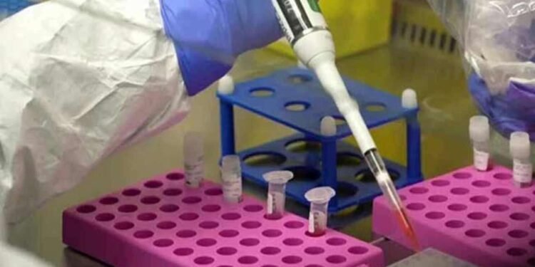 நிப்பா வைரஸ் குறித்து அச்சம் வேண்டாம்: சுகாதார பிரதி அமைச்சர் உறுதி!